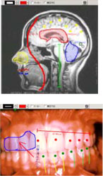 ��������v��