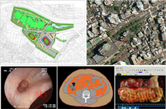 �ȈՌv���]�[�j���O