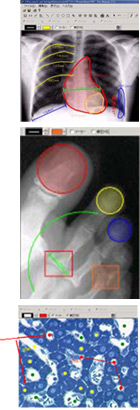 �����g�Q���ʐ^ �������ʐ^